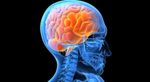 Los diez mitos sobre el cerebro: Usted puede tener agujeros en el cerebro a través del uso de drogas