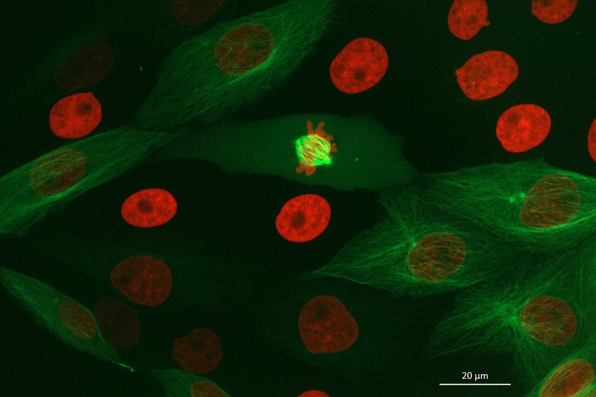 Células en división mitótica vistas con microscopía de fluorescencia, con los cromosomas y el huso teñidos de colores