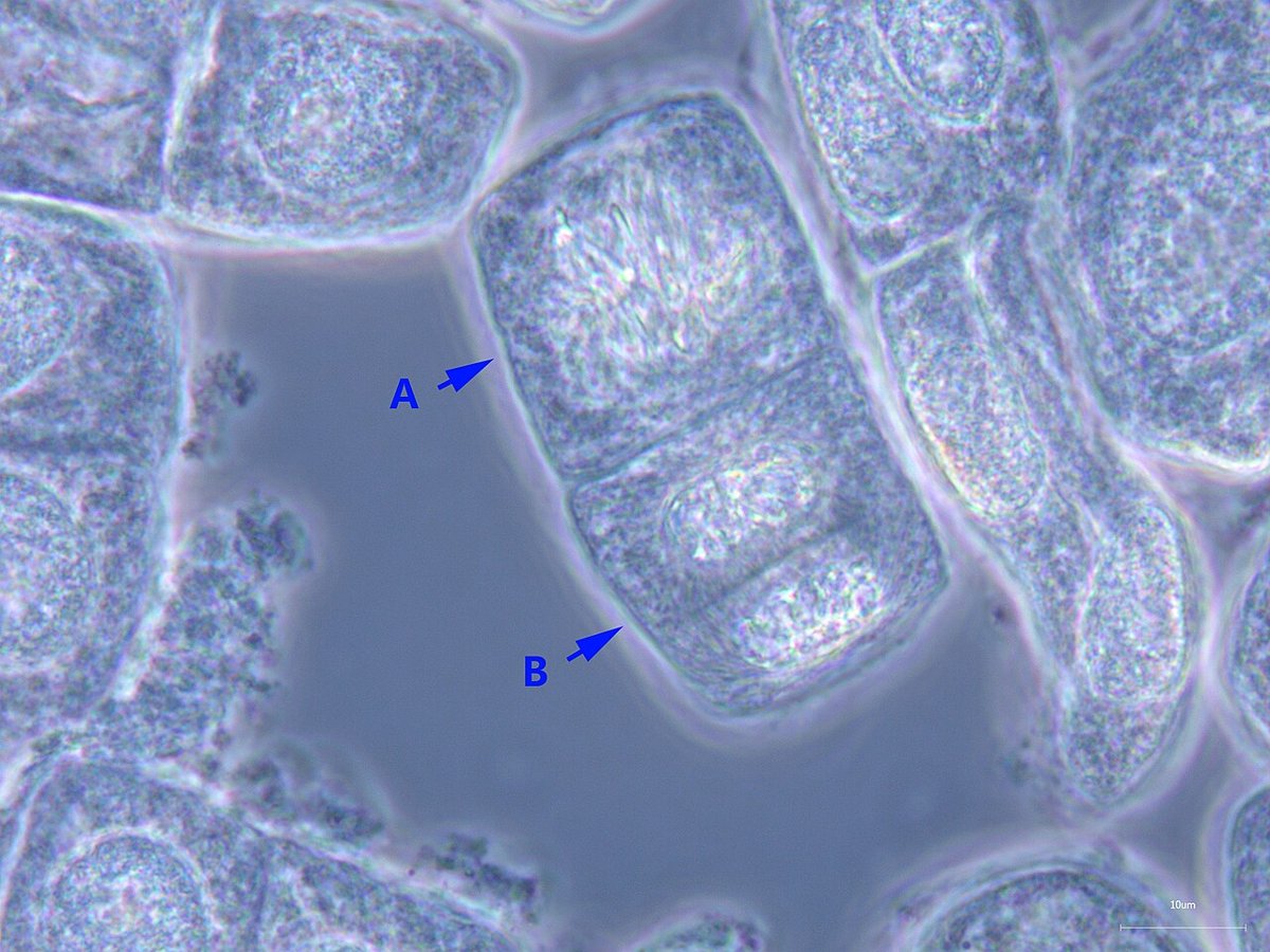 Células de la punta de la raíz de cebolla al microscopio, varias de ellas en mitosis